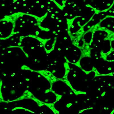 Cover image for research topic "Recent Advances in Endothelial Progenitor Cells Toward Their use in Clinical Translation"