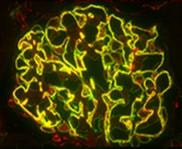 Cover image for research topic "Podocyte Pathology and Nephropathy – an update"