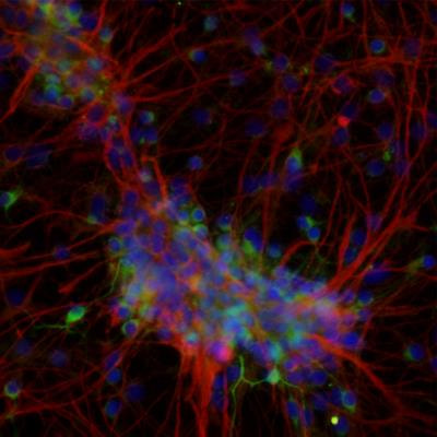 Cover image for research topic "The role of Stem Cells, Epigenetics and MicroRNAs in Parkinson's disease"