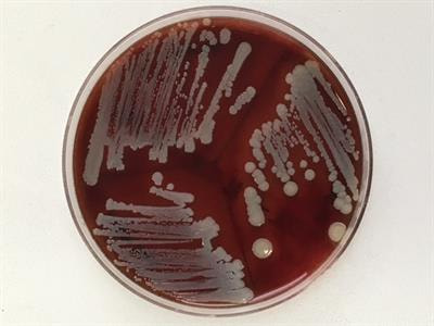 Cover image for research topic "New epidemiology of Staphylococcus Aureus Complex from the Tropics "