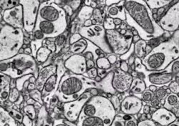 Cover image for research topic "Electron-Microscopy-Based Tools for Imaging Cellular Circuits and Organisms"
