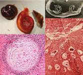 Cover image for research topic "Schistosomiasis: Host-Parasite interactions"
