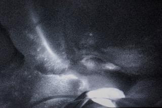 Cover image for research topic "Nanocarriers for Theranostics and Image-Guided Surgery"