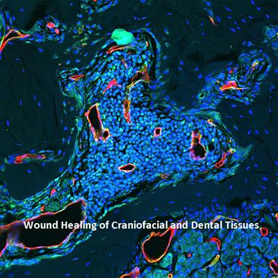 Cover image for research topic "Wound Healing of Craniofacial and Dental Tissues"