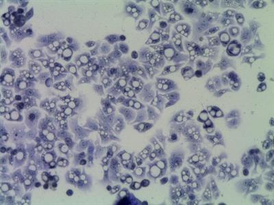 Cover image for research topic "Autophagy and Related Transcription Factors in Liver and Gut Diseases"