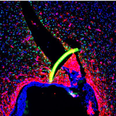 Cover image for research topic "Bridging the Gap in Neuroelectronic Interfaces"