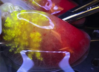 Cover image for research topic "Lung Microvascular Niche, Repair and Engineering"