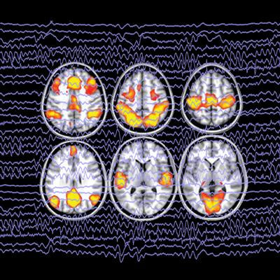 Cover image for research topic "Comparing EEG and fMRI Measurements of the Brain Resting State"