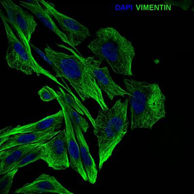 Cover image for research topic "Emerging Mechanisms in Neuronal Signaling: from Cell Biology to Pathogenesis"