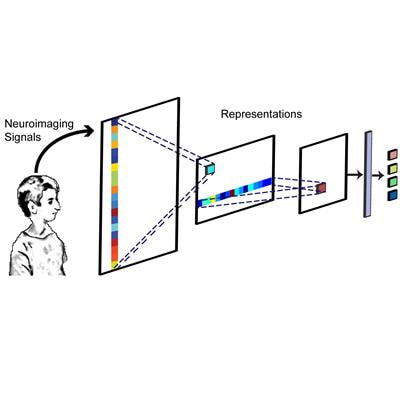 Cover image for research topic "Recent Developments of Deep Learning in Analyzing, Decoding, and Understanding Neuroimaging Signals"