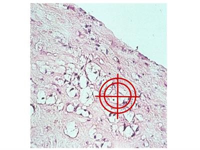 Cover image for research topic "Targeting Monocytes/Macrophages to Treat Atherosclerotic Inflammation"