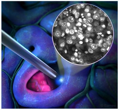 Cover image for research topic "Applications of Fluorescence in Surgery and Interventional Diagnostics"