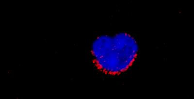 Cover image for research topic "Strategies to Fight Exercise Intolerance in Neuromuscular Disorders"