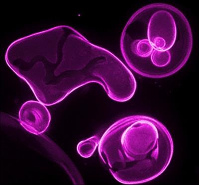 Cover image for research topic "Connections to Membrane Trafficking Where you Least Expect Them: Diseases, Dynamics, Diet and Distance"