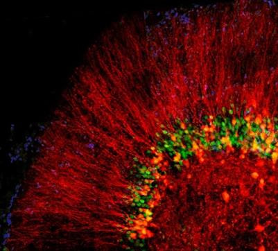 Cover image for research topic "Exercise Shapes up Brain Health"