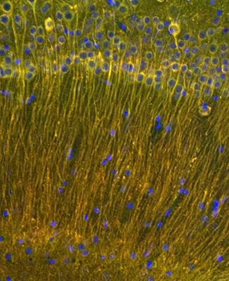 Cover image for research topic "Metabolic Signaling Dysregulation and Cognitive Impairments in Aging and Alzheimer’s Disease"