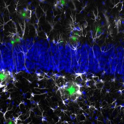 Cover image for research topic "Identification of Multiple Targets in the Fight against Alzheimer’s Disease"