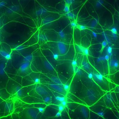 Cover image for research topic "Cutting-Edge Approaches for CNS Protection and Repair: Focus on Vascular and Degenerative Disorders"