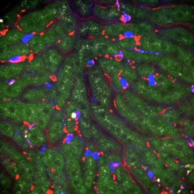 Cover image for research topic "Platelets and Immune Responses during Thromboinflammation"