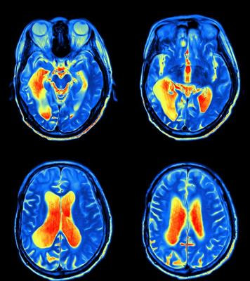 Cover image for research topic "Magnetic Resonance Imaging for Radiation Therapy"