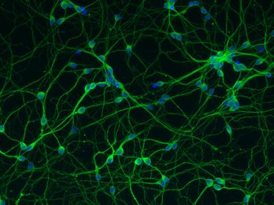 Cover image for research topic "Immune Cell Interactions with Target Cells in Physiological and Pathological Conditions of the Nervous System"