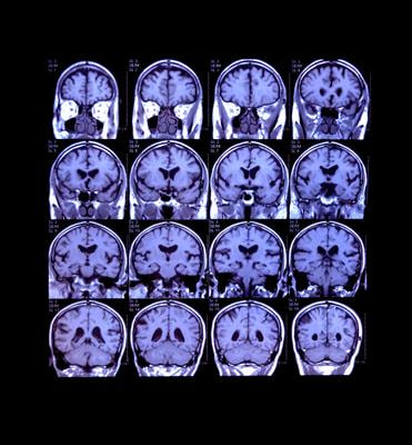 Cover image for research topic "Progress in Translational Neuroimaging: Integrating Pathways, Systems and Phenomenology in Neurology and Psychiatry"