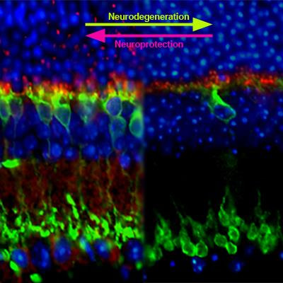 Cover image for research topic "Neurodegeneration and Neuroprotection in Retinal Disease"