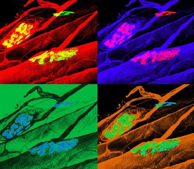 Cover image for research topic "Current Insights into LAMA2 Disease"