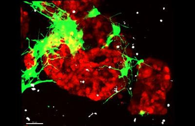Cover image for research topic "Modeling Human Diseases Using Next-Generation Cell Culture Systems"
