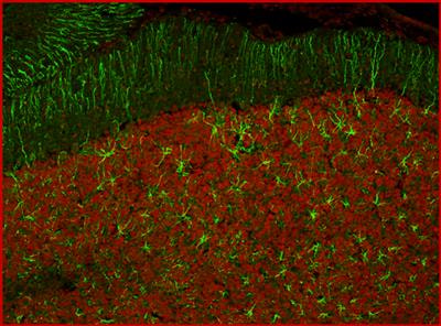 Cover image for research topic "Astrocytes, a Kaleidoscope of Diversities, a Pharmacological Horizon"