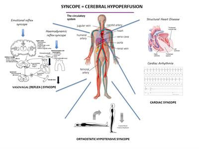 Cover image for research topic "Syncope: Today and Tomorrow"