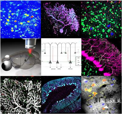 Cover image for research topic "Circuit Mechanisms of Neurodegenerative Diseases"
