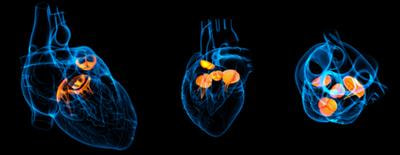 Cover image for research topic "Multimodality Imaging in Valvular Heart Disease"