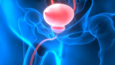 Cover image for research topic "Bladder Cancer – A Cinderella Cancer: Advances and Remaining Research Questions"