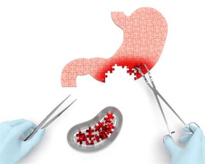 Cover image for research topic "Emerging Diagnostic and Therapeutic Approaches for Gastric Cancer"