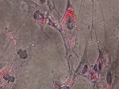 Cover image for research topic "Control of adipocyte differentiation and metabolism"
