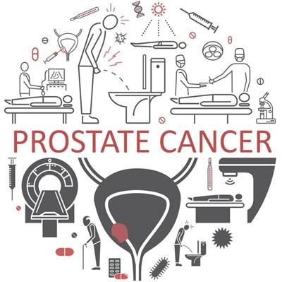 Cover image for research topic "Optimizing Local Therapy for High-Risk Prostate Cancer: Evidence and Emerging Options"
