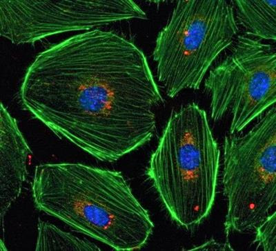 Cover image for research topic "Nanosized Drug Delivery Systems: Colloids and Gels for Site Specific Targeting"
