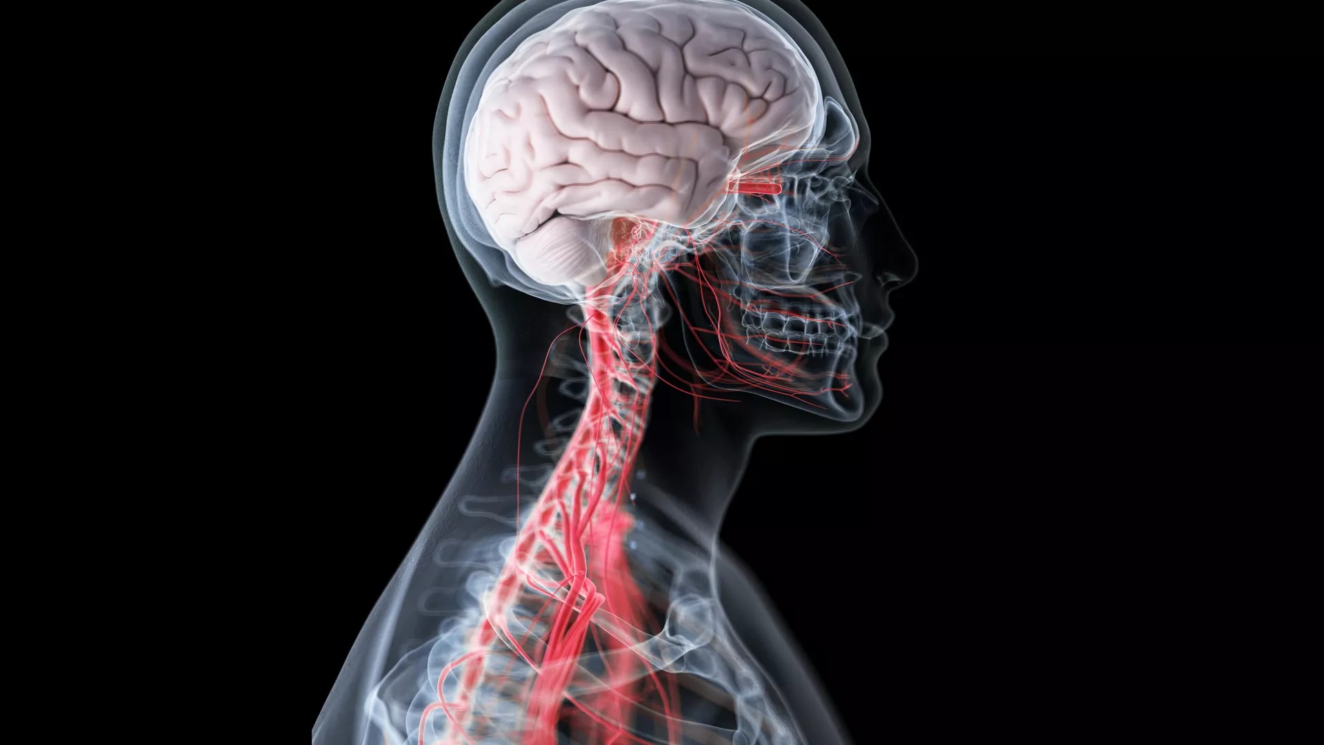 Cover image for "Challenges in Vascular Cognitive Impairment"
