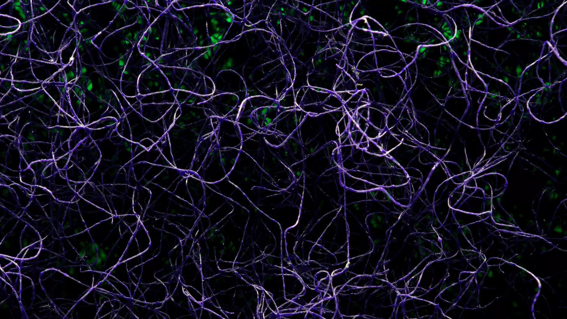 Cover image for "Dynamic Functional Connectivity in  Brain Networks"