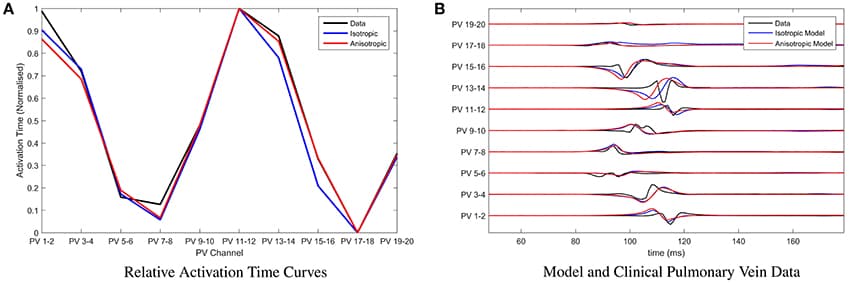 Parameter fitting and comparison with clinical recordings. (A) Presenting the relative activation time curves for the clinical data (presented in full in B) (black), the model assuming isotropic diffusion (blue) and the model assuming anisotropic diffusion (red). Parameters of the model were calibrated by minimizing the root mean squared error between clinical recording and the model using the Nelder-Mead method. (B) Presenting an exemplar of clinical pulmonary vein recordings collected during pulmonary vein isolation therapy at the Bristol Heart Institute (black). Overlaid are the model simulations, with parameters calibrated as described in (A), under the assumption of isotropic diffusion (blue) and isotropic diffusion (red) respectively.