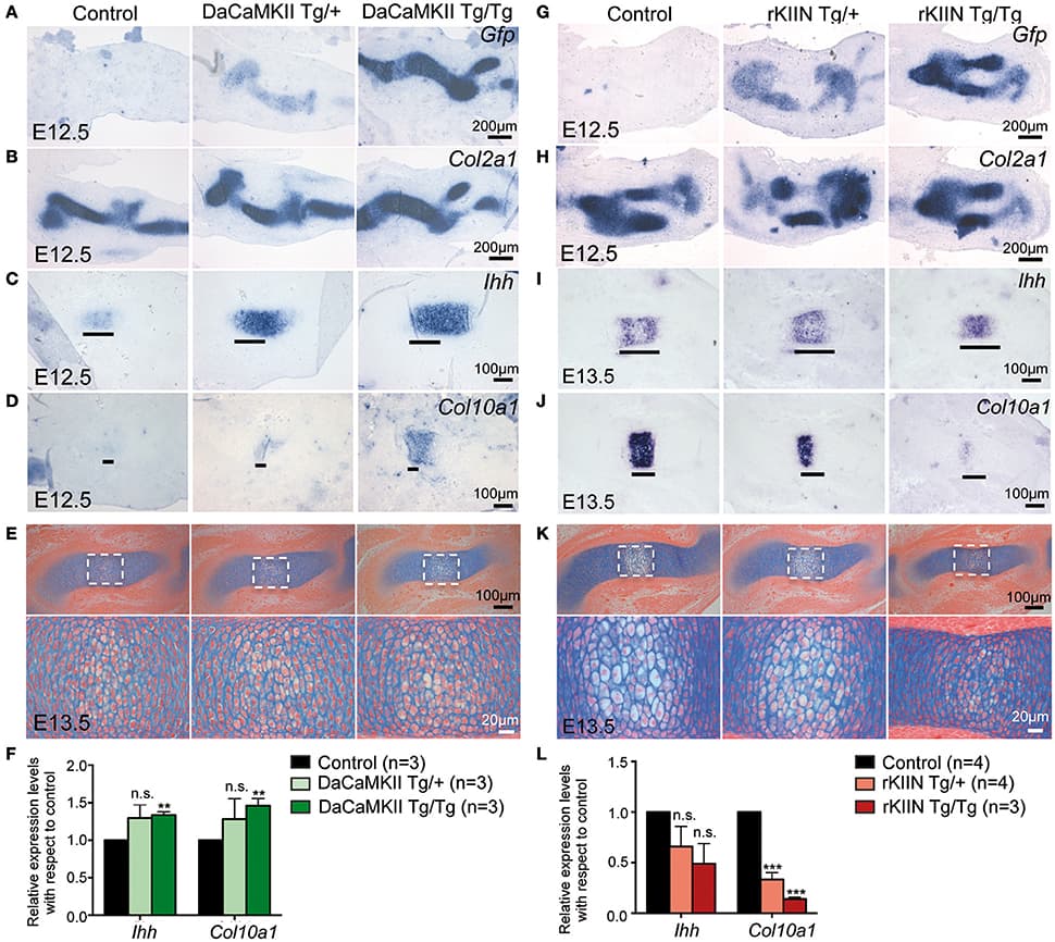 Modulation of CaMKII signaling affects the onset of chondrocyte maturation in early skeletal development. (A–D) Representative, alternating sections through humeri of E12.5 control (non-transgenic, +/+), hetero- (Tg/+), and homozygous (Tg/Tg) DaCaMKII-tg littermates. (A) Gfp ISH revealing transgene expression in heterozygous and homozygous animals but not in non-transgenic littermate controls. (B) Col2a1 ISH confirming that the transgene expression is restricted to the Col2a1 positive domain. (C) Ihh ISH defining the prehypertrophic zone, which is enlarged in the homozygous and heterozygous transgenic embryos. (D) Col10a1 ISH marking the onset of hypertrophic chondrocyte differentiation. Col10a1 expression was more intense in the transgenic embryos compared to control (non-transgenic) littermates. (E) Alcian blue/eosin stained representative images of sections through E13.5 humeri of control (non-transgenic; +/+), hetero- (Tg/+), and homozygous (Tg/Tg) DaCaMKII-tg embryos. Images below show magnifications of the boxed areas in the panel above. Due to their increase in volume and vacuolization of the cells, the hypertrophic chondrocytes appear whiter. The region of hypertrophy is enlarged in the transgenic humeri compared to wild-type littermate control. (F) qPCR analysis for Ihh and Col10a1 normalized to Gapdh and Actb using material from E12.5 control, hetero- and homozygous DaCaMKII-tg forelimbs reveals a dose-dependent increase in the expression of these two genes. Gene expression levels are plotted relative to control. (G–J) Representative, alternating sections through humeri of E12.5 (G,H) and E13.5 (I,J) control (non-transgenic; +/+) and hetero- (Tg/+), and homozygous (Tg/Tg) rKIIN-tg littermates. (G) Gfp ISH revealing transgene expression in heterozygous and homozygous animals but not in non-transgenic littermate controls. (H) Col2a1 ISH confirming that the transgene expression is restricted to the Col2a1 positive domain. (I) Ihh ISH defining the prehypertrophic zone, which is reduced in a transgene dose-dependent manner in the hetero- and homozygous transgenic embryos. (J) Col10a1 ISH defining the hypertrophic zone, showing that hypertrophic differentiation is even more delayed. (K) Histological alcian blue/eosin stained representative images of sections from control, hetero- and homozygous rKIIN embryos: here, fewer and smaller hypertrophic, whiter cells are visible in hetero- and homozygous transgenic humeri compared to wild-type littermate controls. (L) qPCR analysis for Ihh and Col10a1 normalized to Gapdh and Actb using material from E13.5 control, hetero- and homozygous rKIIN-tg forelimbs revealing a dose-dependent reduction in the expression of Ihh and Col10a1. Gene expression levels are plotted relative to control. (F,L) n refers to the number of independent biological samples. **p < 0.01, ***p < 0.001, n.s., not significant. Error bars indicate ± SEM.