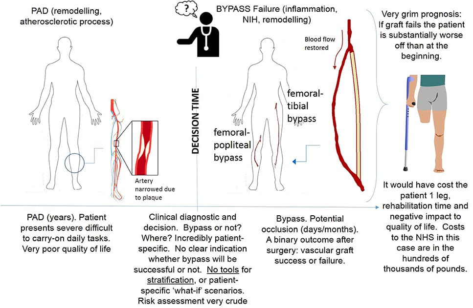 Procedure leading to bypass surgery.