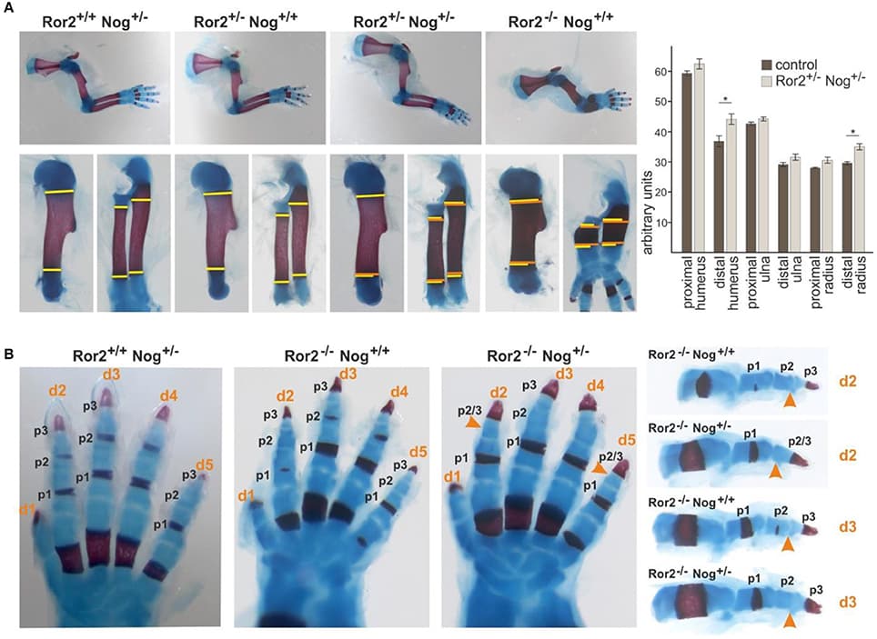 Noggin genetically interacts with Ror2. Skeletal preparations of E18.5 embryos of the indicated allelic combinations are shown. Cartilage stains blue, bone stains red. (A) Top panel: Limbs of compound Ror2 and Noggin heterozygous mutants have a normal appearance. Ror2−/− skeletal elements are visibly shortened and enlarged. Bottom panel: magnifications of humerus and radius/ulna. The width of the wild type or single heterozygous skeletal elements is indicated by a yellow line on either side of the ossification center. Width of the double heterozygous or Ror2−/− skeletal elements is indicated by orange line for comparison. A quantification of skeletal element width is shown right; significant effects were observed for the distal humerus and distal radius (p < 0,05; student's t-test). (B) Digit development in compound mutants. Ror2−/− digits are shortened, but individual phalanges (p1, p2, and p3) are present, separated by synovial joints. In Ror2−/−;Nog+/− animals, the medial phalange (p2) shows additional shortening, which in digits 2 and 5 leads to distal symphalangism of p2 and p3.