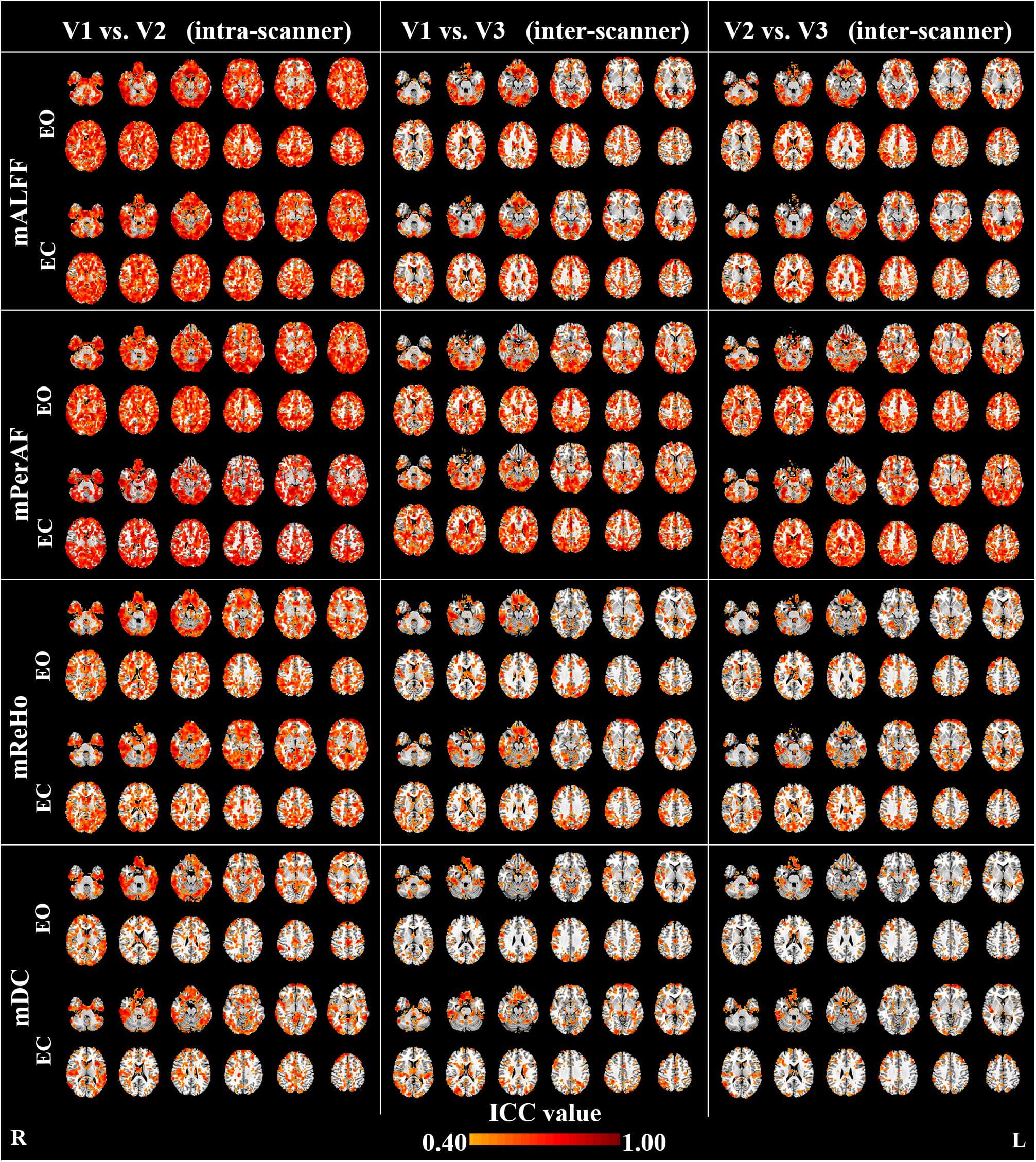 The intra- and inter-scanner reliability of mALFF, mPerAF, mReHo and mDC of eyes open (EO) and eyes closed (EC). The Z coordinates were from –36 to +52 with a step of 8 mm. ICC: intra-class correlation. V: visit.