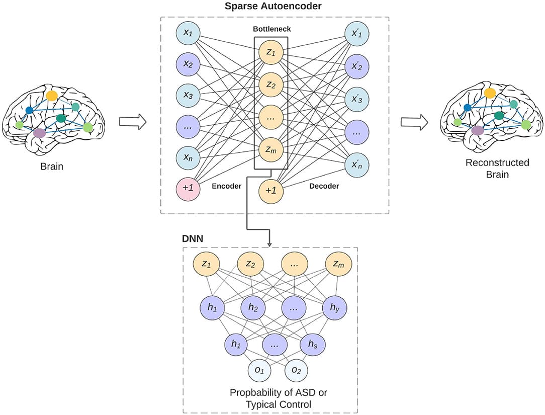 An overview of our proposed model and how the sparse autoencoder is used as feature selection to the deep neural network. The limitation of the feature lead to better generalizability of the model across various data-acquisition sites, and may lead to better interpretability of the models.