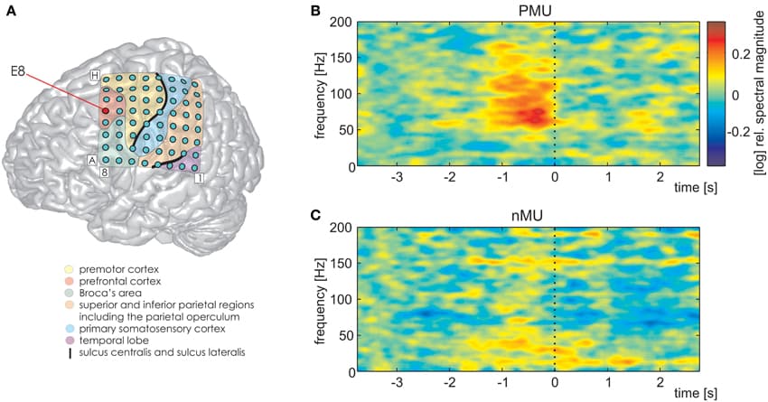 Differential PMU- and nMU-related responses in the left prefrontal cortex of S1. Red circle in (A) marks the prefrontal electrode with significant differences (Wilcoxon rank sum test, FDR-corrected at q < 0.01) between the two categories. (B) PMU-related responses, (C) nMU-related responses. High gamma spectral magnitude was stronger in IUs with personal memory content than in those without such content. Other details as in Figures 3–5.
