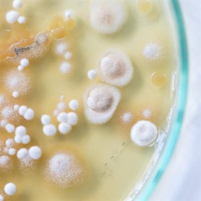 Cover image for research topic "New Threats of Antibiotic-Resistant Bacteria and Fungi"
