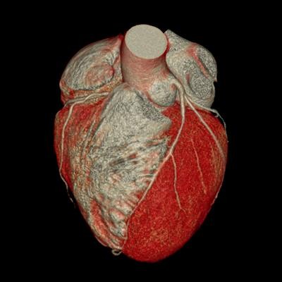Cover image for research topic "Current Trends and Approaches in the Comprehensive Evaluation of Coronary Artery Disease"