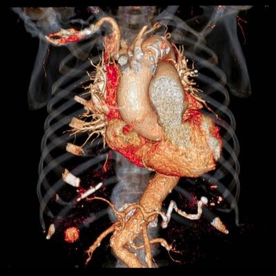 Cover image for research topic "Imaging in Structural Heart Interventions"